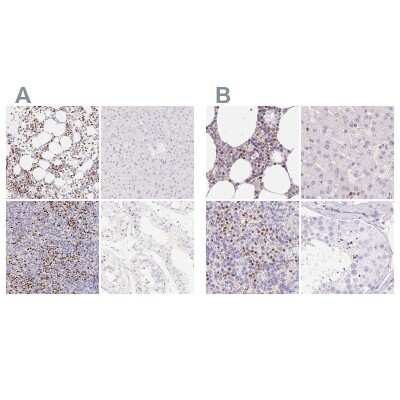 Immunohistochemistry-Paraffin: PADI4 Antibody [NBP1-87353]