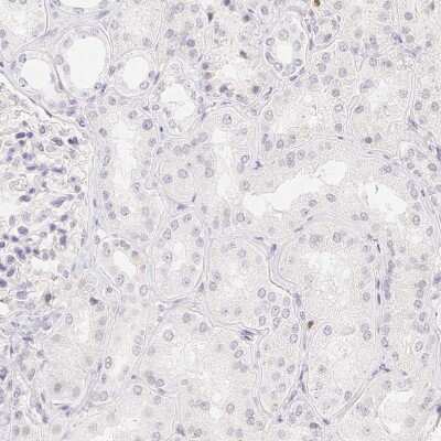 Immunohistochemistry-Paraffin: PADI4 Antibody [NBP1-87353]