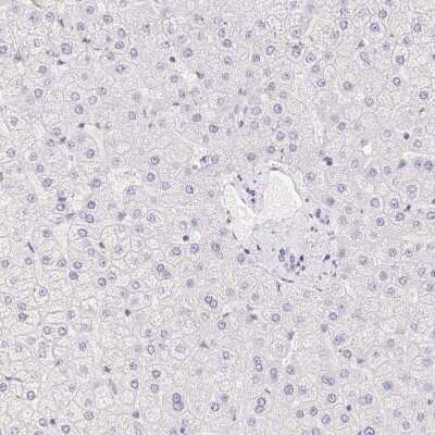 Immunohistochemistry-Paraffin: PADI4 Antibody [NBP1-87353]