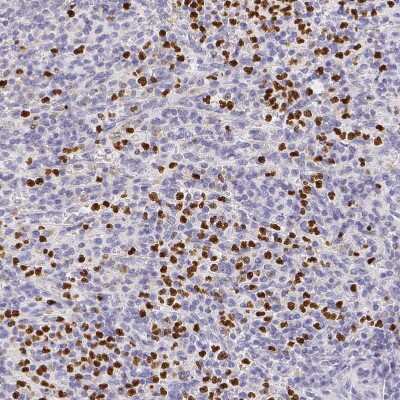 Immunohistochemistry-Paraffin: PADI4 Antibody [NBP1-87353]