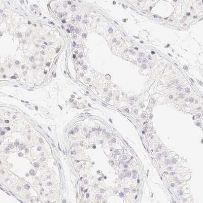 Immunohistochemistry-Paraffin: PADI4 Antibody [NBP1-87353]
