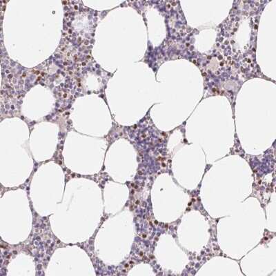 Immunohistochemistry-Paraffin: PADI4 Antibody [NBP2-38499]