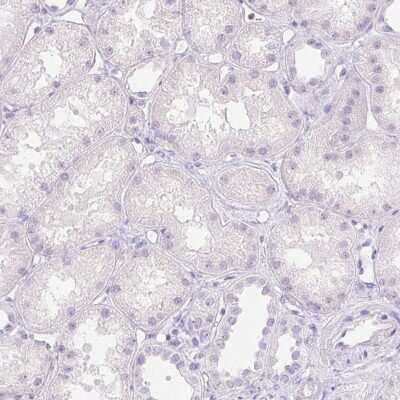 Immunohistochemistry-Paraffin: PADI4 Antibody [NBP2-38499]