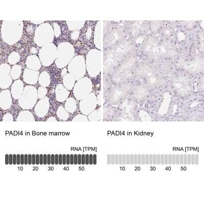 Immunohistochemistry-Paraffin: PADI4 Antibody [NBP2-38499]