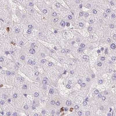 Immunohistochemistry-Paraffin: PADI4 Antibody [NBP2-38499]