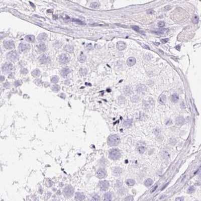 Immunohistochemistry-Paraffin: PADI4 Antibody [NBP2-38499]