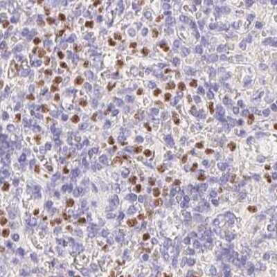 Immunohistochemistry-Paraffin: PADI4 Antibody [NBP2-38499]