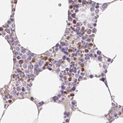 Immunohistochemistry-Paraffin: PADI4 Antibody [NBP2-38499]