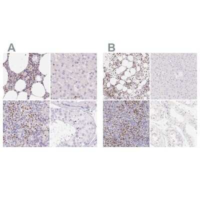 Immunohistochemistry-Paraffin: PADI4 Antibody [NBP2-38499]