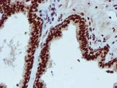 Immunohistochemistry: PADI4 Antibody (OTI4H5) - Azide and BSA Free [NBP2-73226]