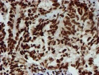 Immunohistochemistry: PADI4 Antibody (OTI4H5) - Azide and BSA Free [NBP2-73226]