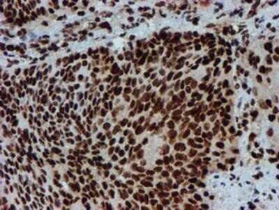 Immunohistochemistry: PADI4 Antibody (OTI4H5) - Azide and BSA Free [NBP2-73226]