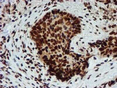 Immunohistochemistry: PADI4 Antibody (OTI4H5) - Azide and BSA Free [NBP2-73226]