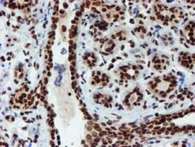 Immunohistochemistry: PADI4 Antibody (OTI4H5) - Azide and BSA Free [NBP2-73226]