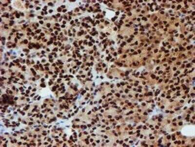 Immunohistochemistry: PADI4 Antibody (OTI4H5) - Azide and BSA Free [NBP2-73226]