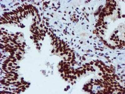 Immunohistochemistry: PADI4 Antibody (OTI4H5) - Azide and BSA Free [NBP2-73226]