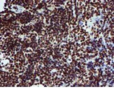 Immunohistochemistry-Paraffin: PADI4 Antibody (OTI4H5) [NBP2-02082]