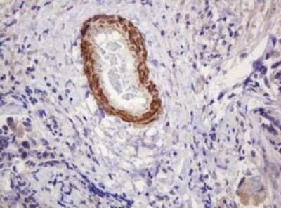 Immunohistochemistry: PADI4 Antibody (OTI5C10) - Azide and BSA Free [NBP2-73228]