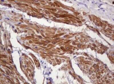 Immunohistochemistry: PADI4 Antibody (OTI5C10) - Azide and BSA Free [NBP2-73228]