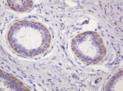 Immunohistochemistry: PADI4 Antibody (OTI5C10) - Azide and BSA Free [NBP2-73228]