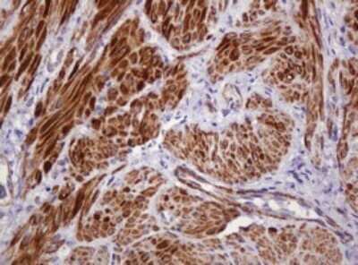 Immunohistochemistry: PADI4 Antibody (OTI5C10) - Azide and BSA Free [NBP2-73228]