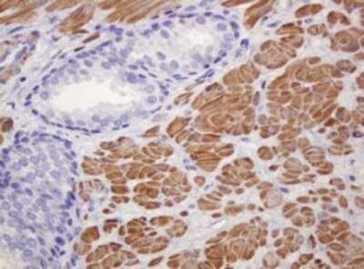 Immunohistochemistry: PADI4 Antibody (OTI5C10) - Azide and BSA Free [NBP2-73228]