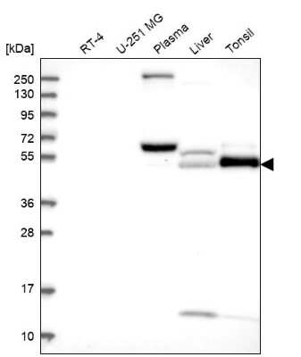 Western Blot: PADI4 Antibody [NBP2-38499]