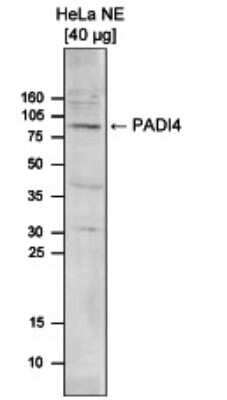 Western Blot: PADI4 Antibody [NBP3-18652]