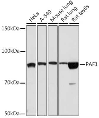 Western Blot: PAF1 Antibody (3U5C4) [NBP3-16185]