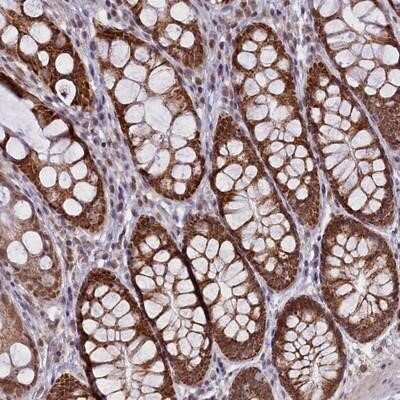 Immunohistochemistry-Paraffin: PAF1 Antibody [NBP2-13724]