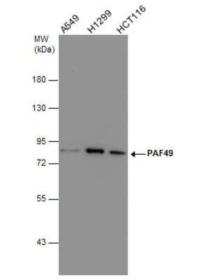 Western Blot: PAF49 Antibody (635) [NBP2-43633]