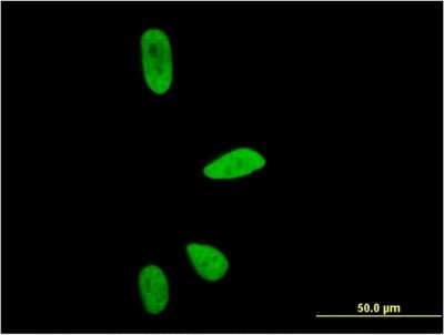 Immunocytochemistry/ Immunofluorescence: PAF49 Antibody (6A6) [H00010849-M05]