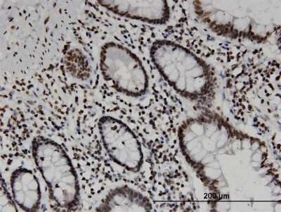 Immunohistochemistry-Paraffin: PAF49 Antibody (6A6) [H00010849-M05]