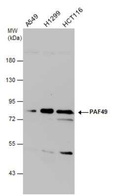 Western Blot: PAF49 Antibody (7212) [NBP2-43592]