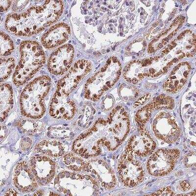 Immunohistochemistry-Paraffin: PAF49 Antibody [NBP1-90084]