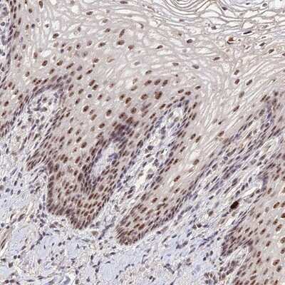 Immunohistochemistry-Paraffin: PAF49 Antibody [NBP1-90085]