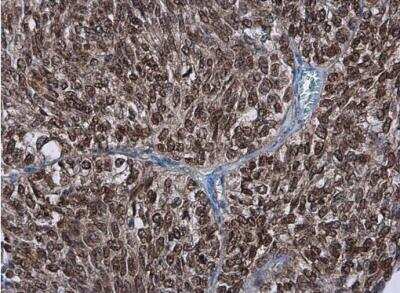Immunohistochemistry-Paraffin: PAF49 Antibody [NBP2-19676]