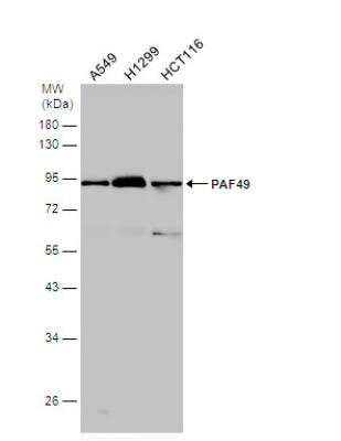 Western Blot: PAF49 Antibody [NBP2-19676]