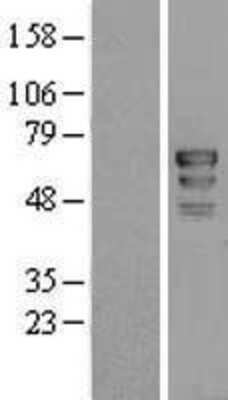 Western Blot: PAF49 Overexpression Lysate [NBL1-08945]