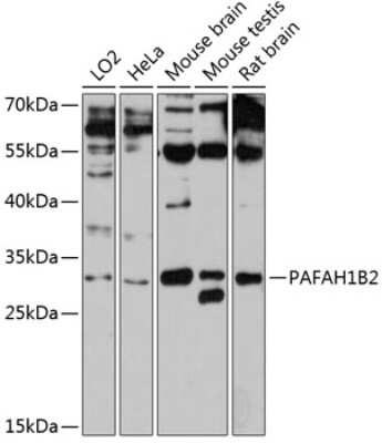 Western Blot: PAFAH1B2 AntibodyAzide and BSA Free [NBP2-93856]