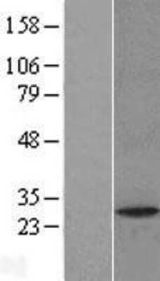 Western Blot: PAFAH1B2 Overexpression Lysate [NBL1-14065]