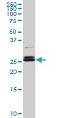 Western Blot: PAFAH1B3 Antibody (3G6) [H00005050-M08]
