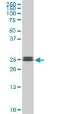 Western Blot: PAFAH1B3 Antibody (3G6) [H00005050-M08]