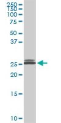 Western Blot: PAFAH1B3 Antibody (3G6) [H00005050-M08]