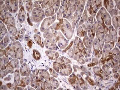 Immunohistochemistry: PAFAH1B3 Antibody (OTI5D2) [NBP2-46314]