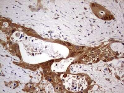 Immunohistochemistry: PAFAH1B3 Antibody (OTI5D2) [NBP2-46314]