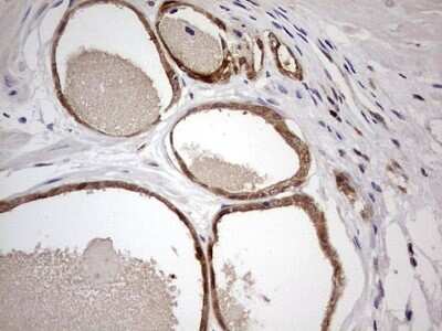 Immunohistochemistry: PAFAH1B3 Antibody (OTI5D2) [NBP2-46314]