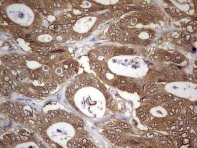 Immunohistochemistry: PAFAH1B3 Antibody (OTI5D2) [NBP2-46314]