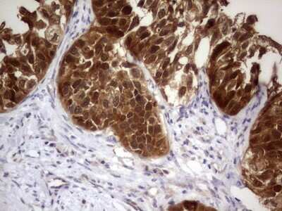 Immunohistochemistry: PAFAH1B3 Antibody (OTI5D2) [NBP2-46314]