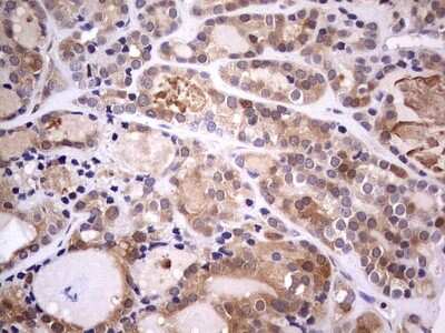 Immunohistochemistry: PAFAH1B3 Antibody (OTI5D2) [NBP2-46314]